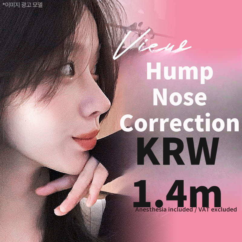 ❤️View❤️Nasal Surgery