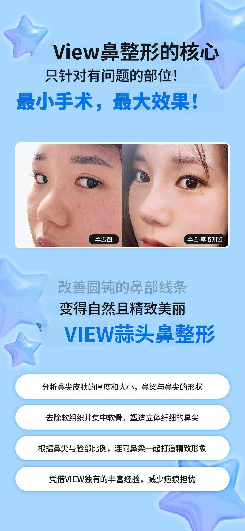 咨询医院