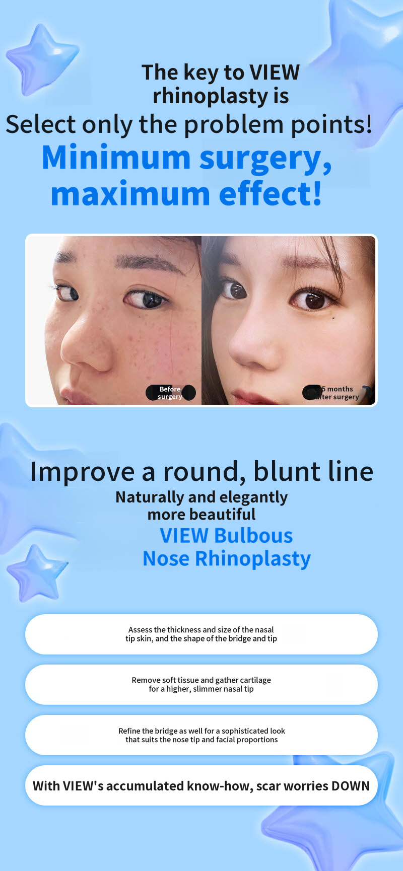 ❤️View❤️Nose Reshaping