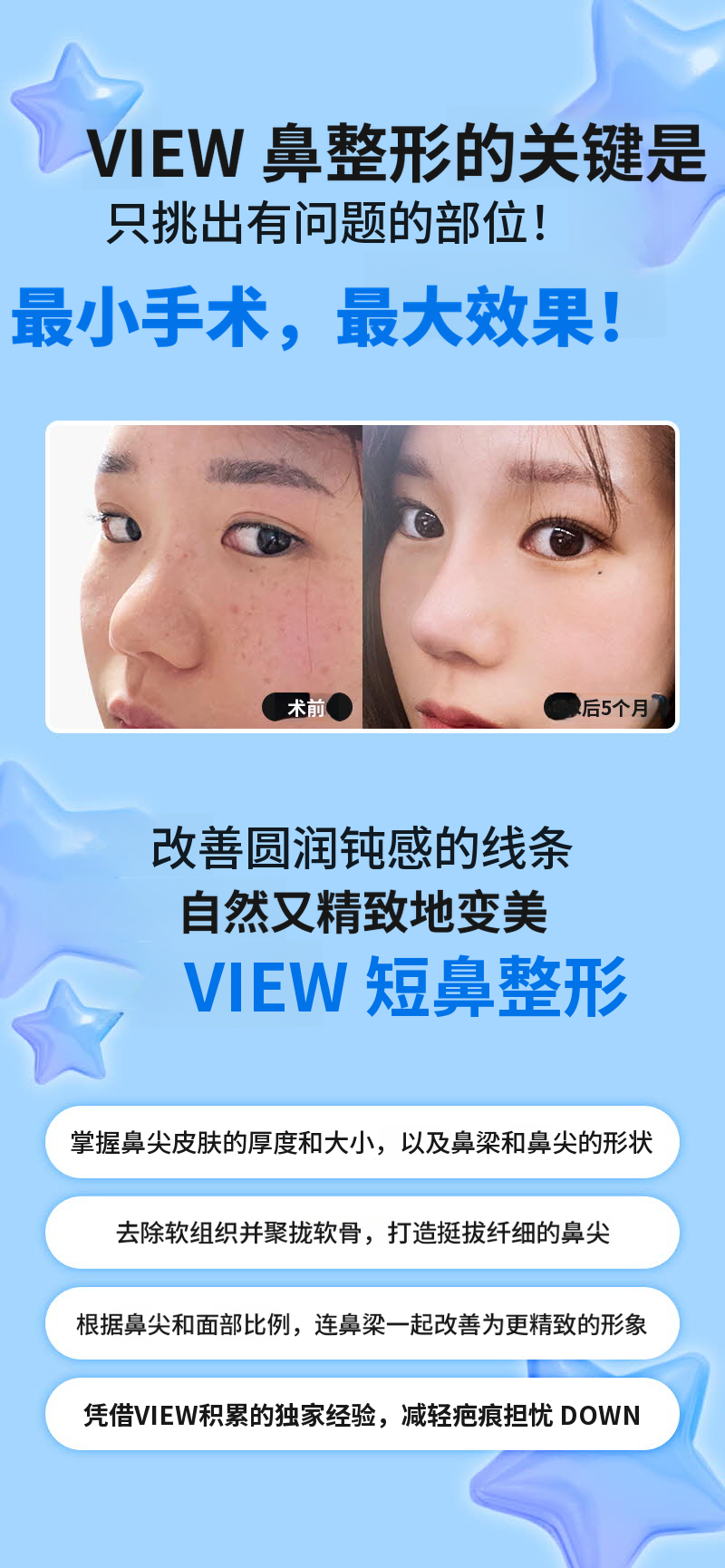 ❤️视❤️鼻整形