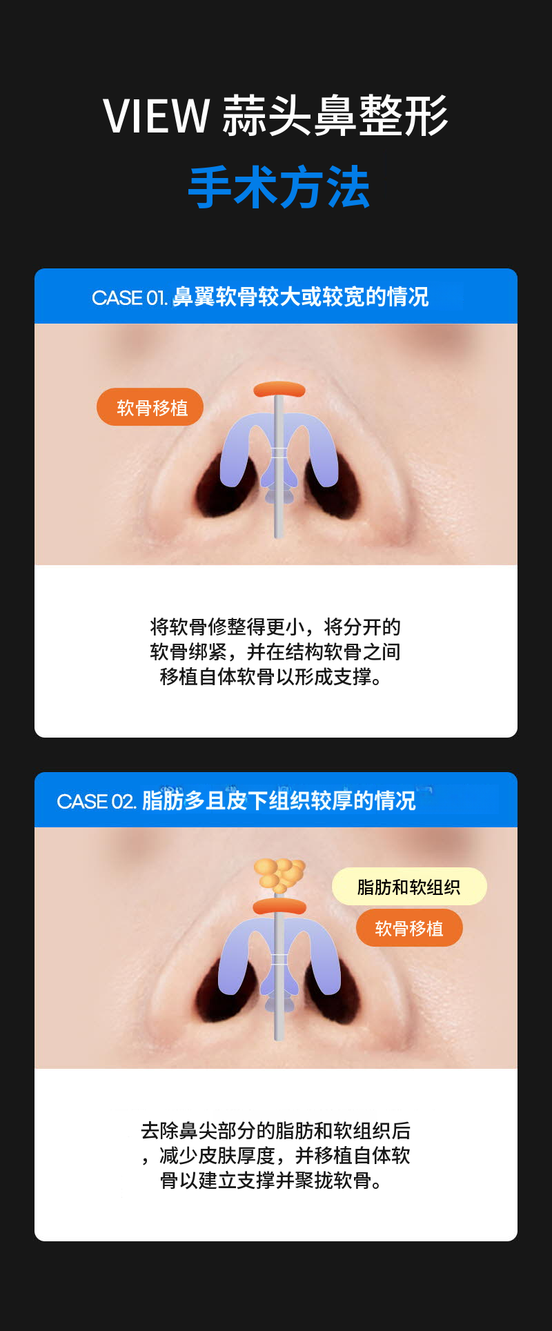咨询医院