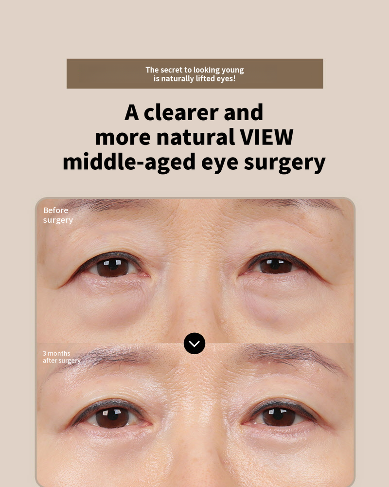 ❤️View❤️Eyebrow Lift Surgery