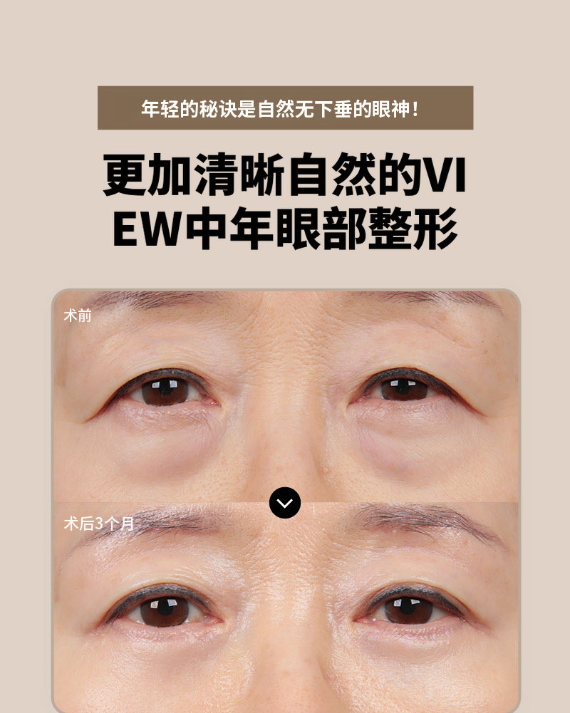 ❤️眉毛提拉术❤️