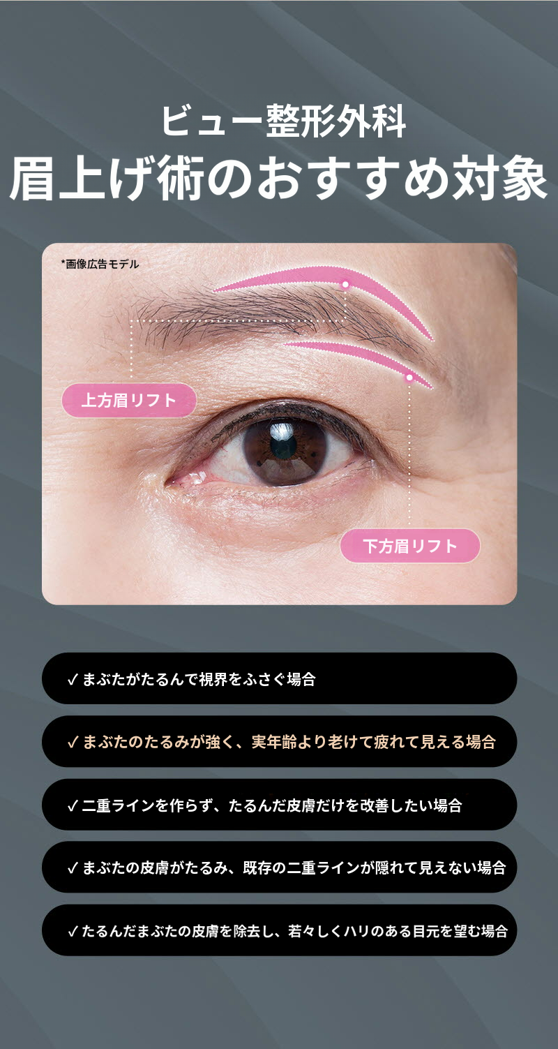 ❤️ビュー❤️眉毛リフト術