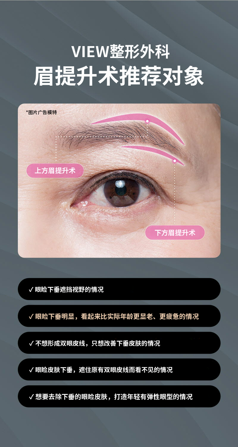 ❤️眉毛提拉术❤️