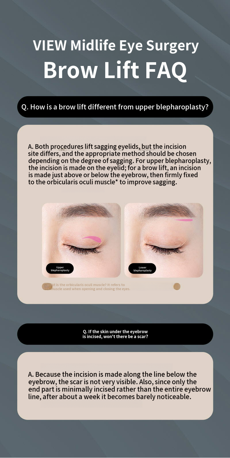 ❤️View❤️Eyebrow Lift Surgery