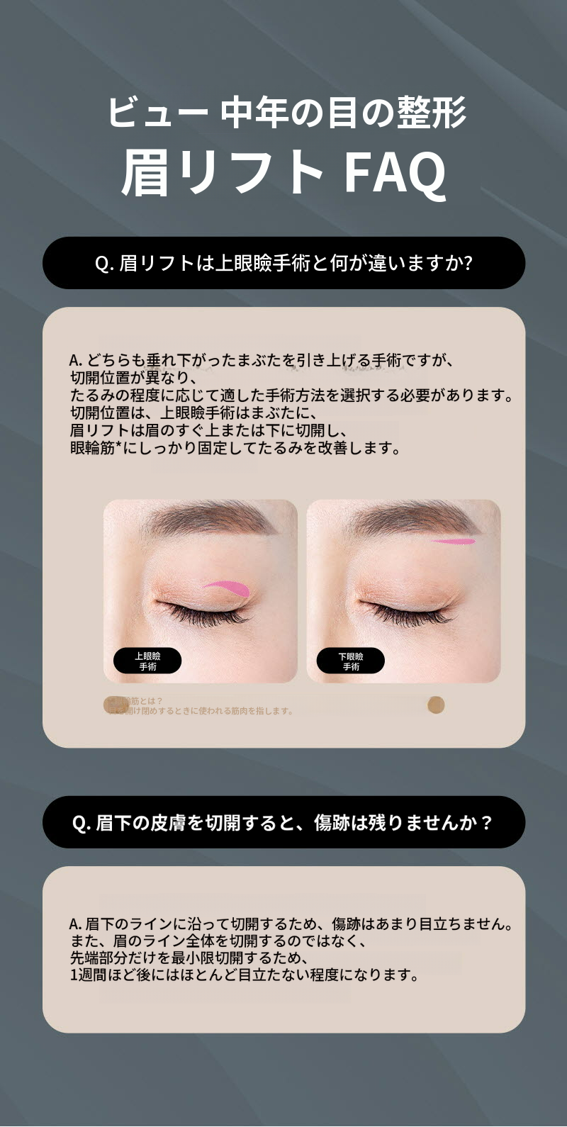 ❤️ビュー❤️眉毛リフト術