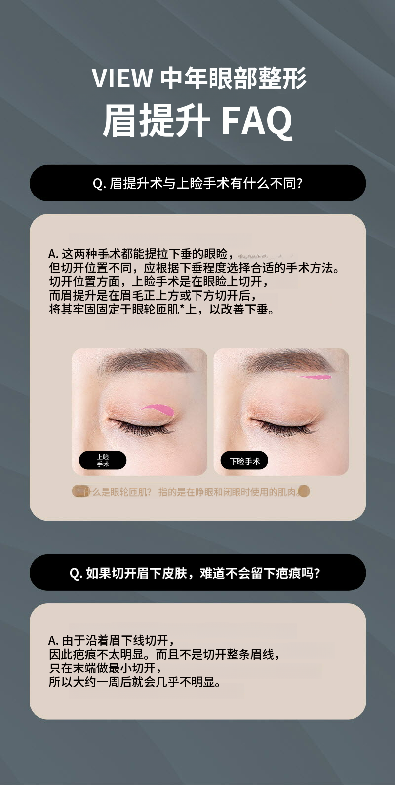 ❤️眉毛提拉术❤️