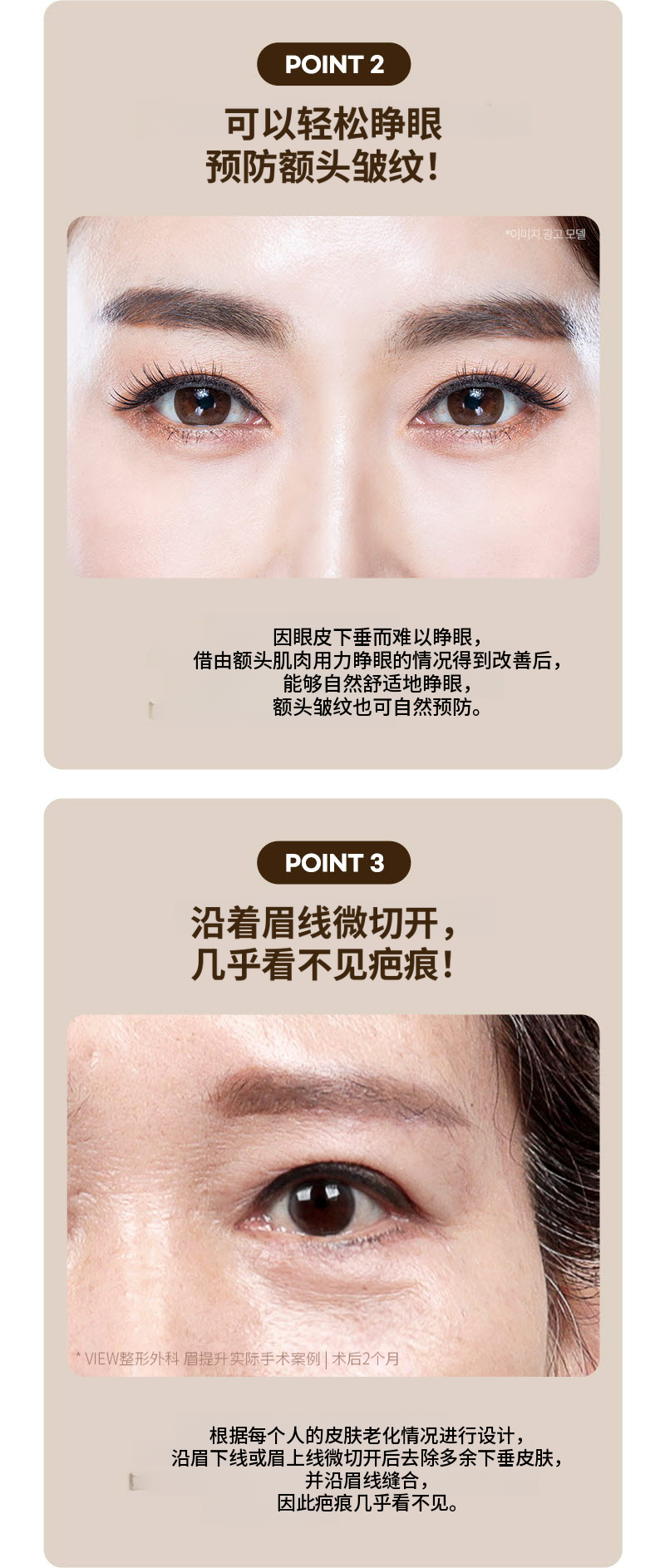 ❤️眉毛提拉术❤️