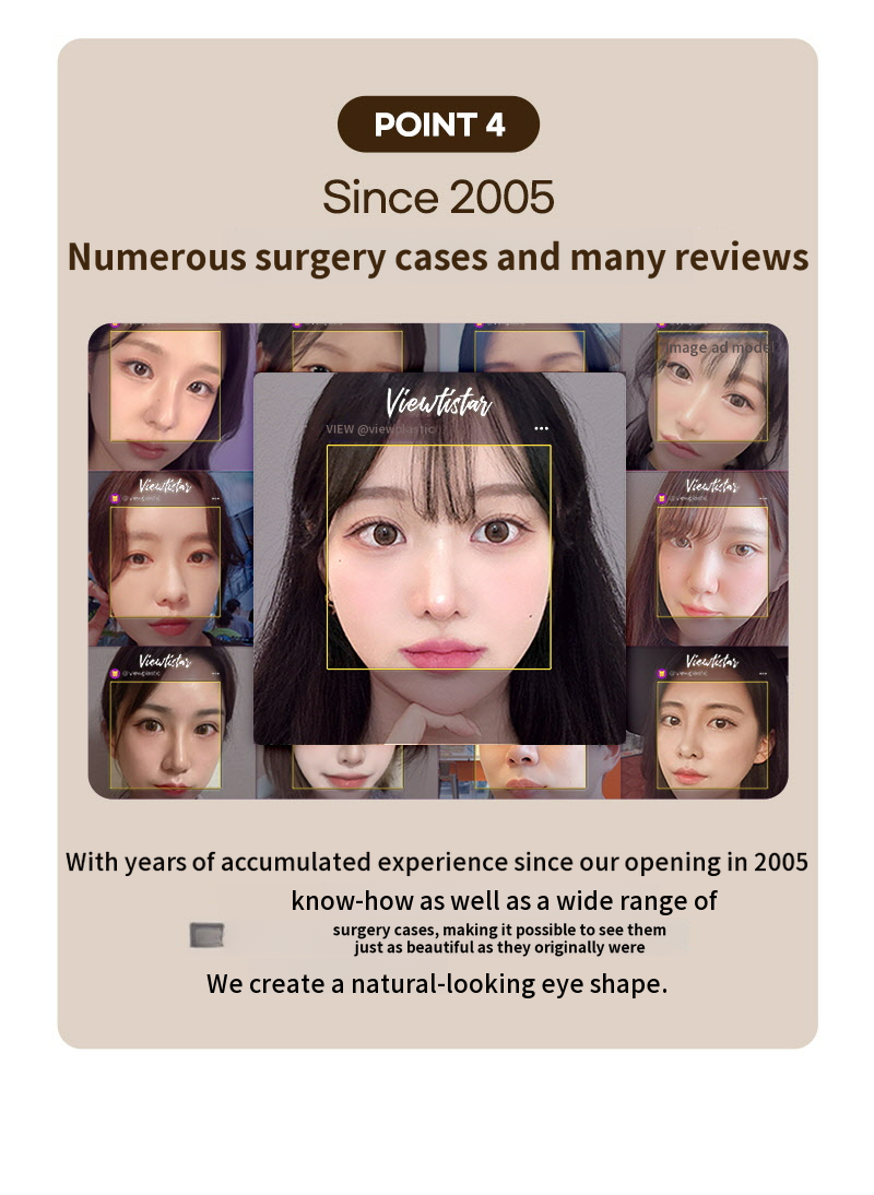 ❤️View❤️Eyebrow Lift Surgery