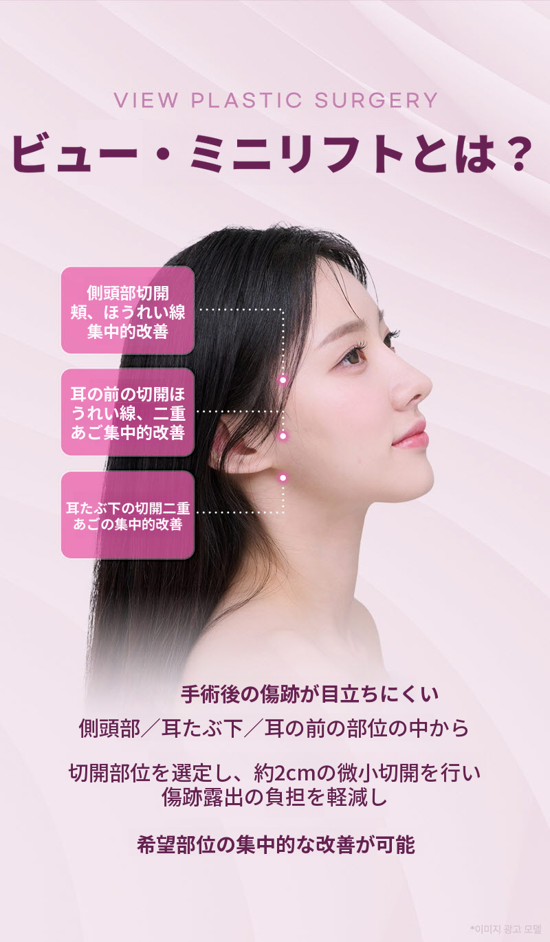 ❤ビュー❤ミニリフト