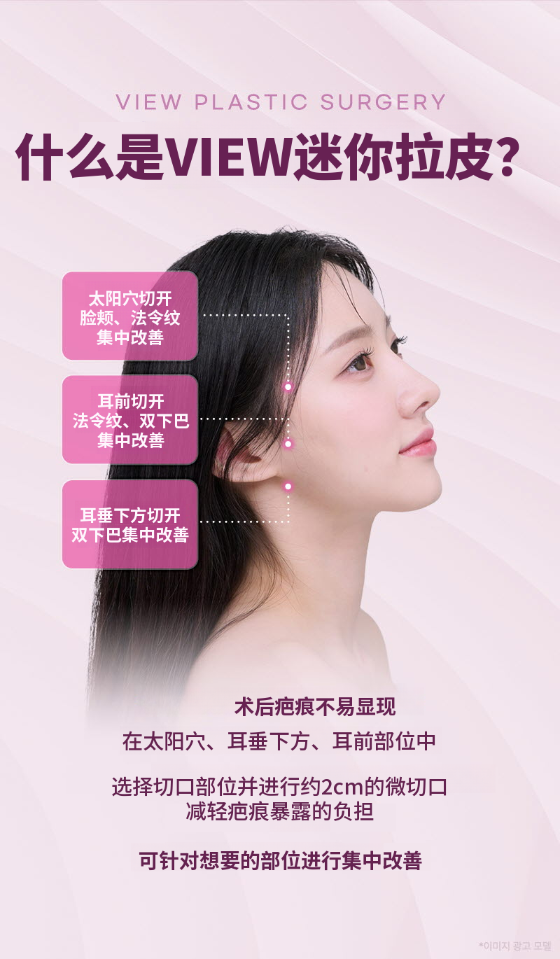 ❤视图❤迷你提拉