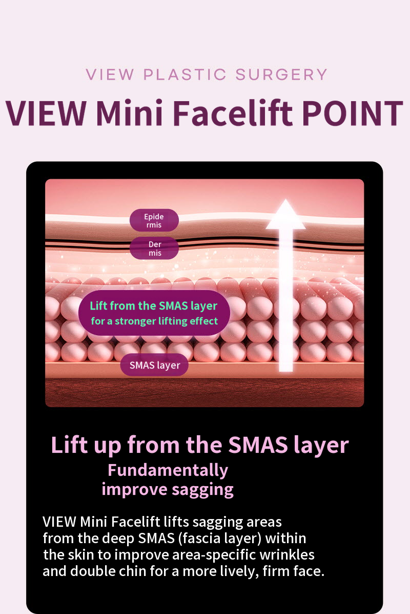 ❤View❤Mini Facelift
