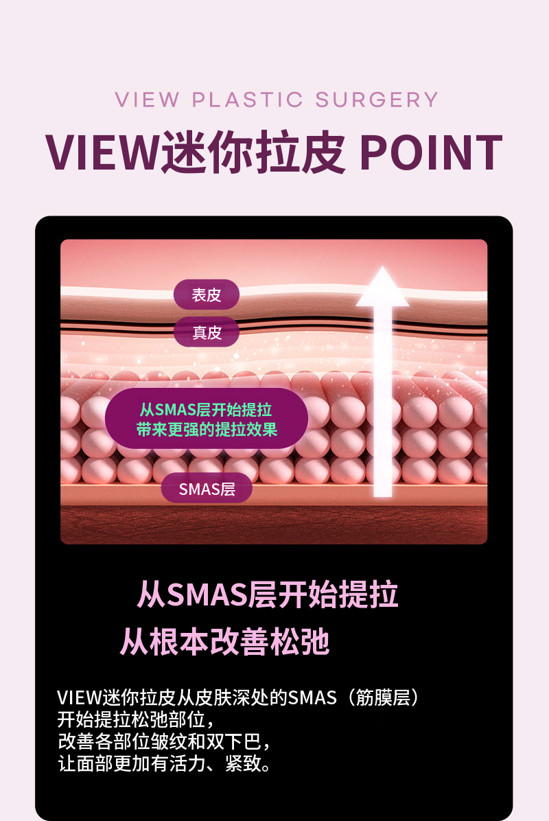 ❤视图❤迷你提拉