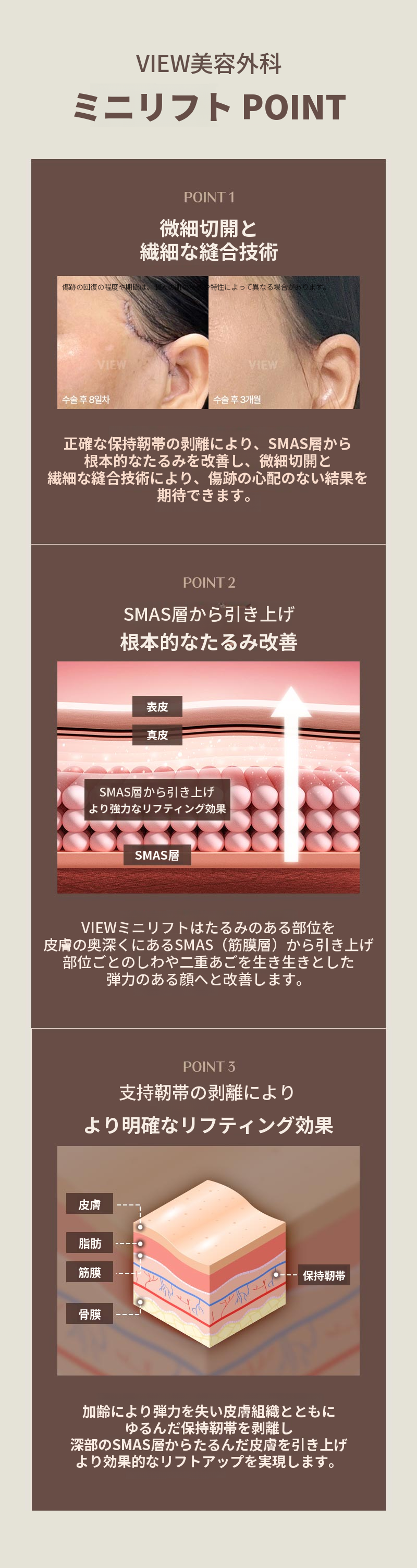 ❤ビューティー❤ミニリフト