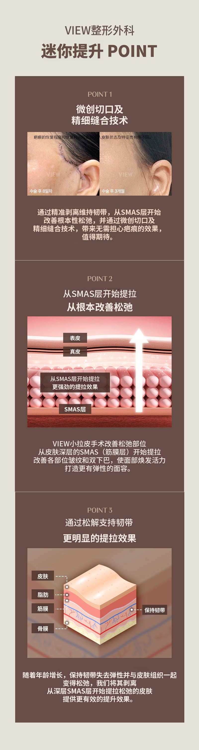 ❤V❤迷你拉皮术