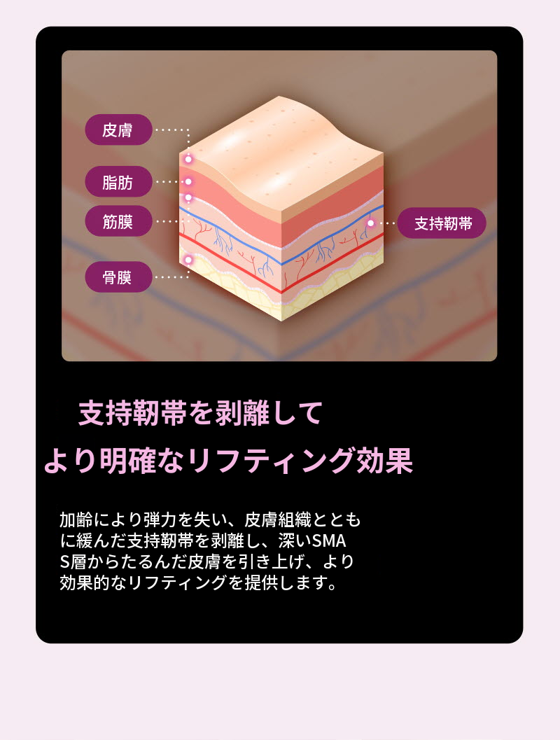 string