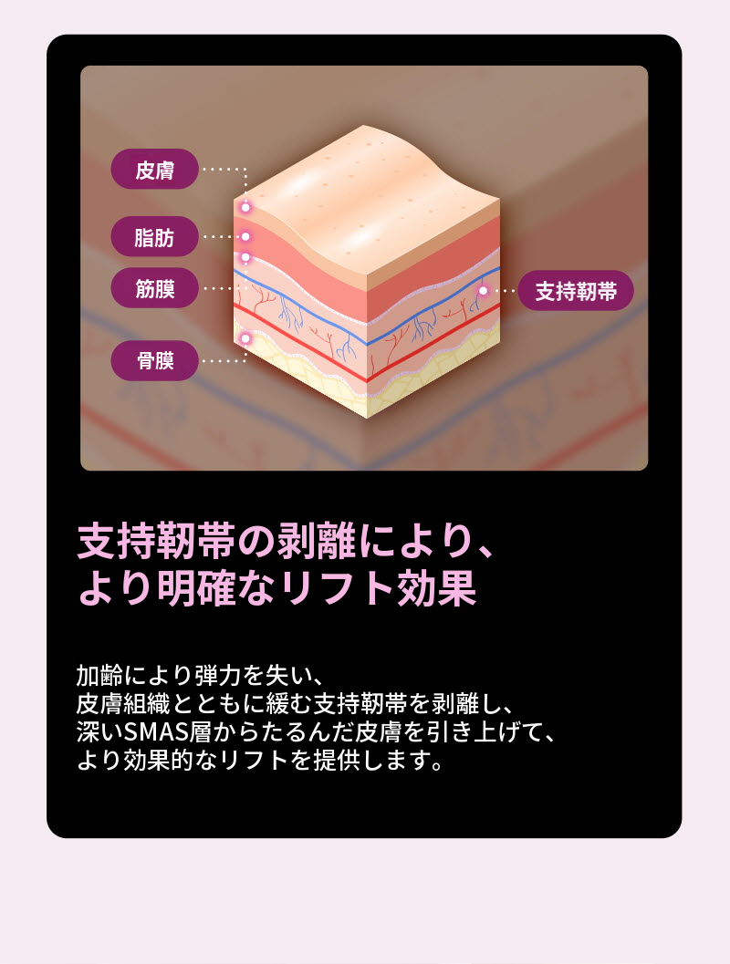 ❤ビュー❤ミニリフト