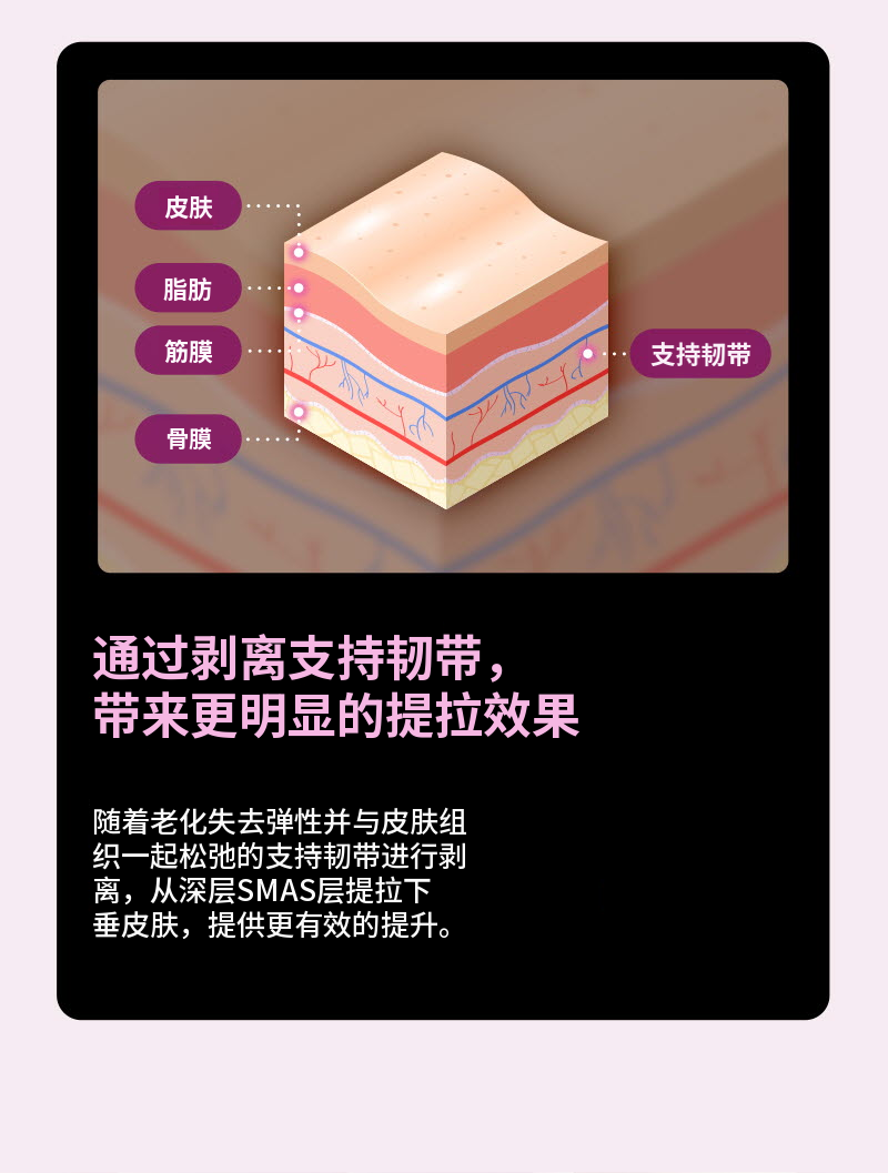 ❤视图❤迷你提拉
