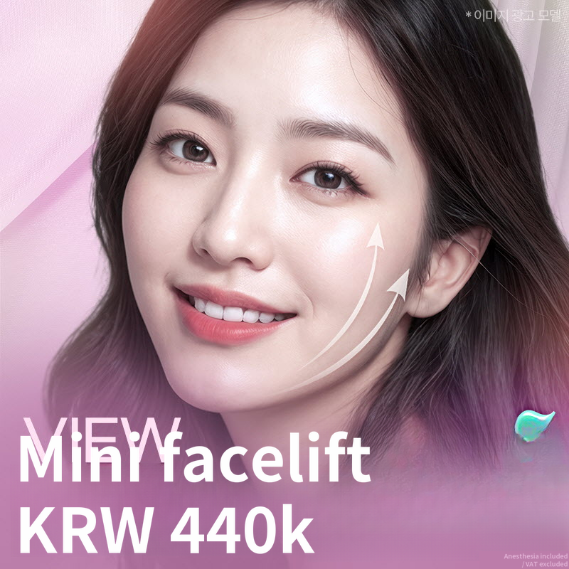 ❤View❤Mini Facelift