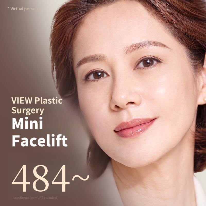 ❤View❤ Mini Facelift
