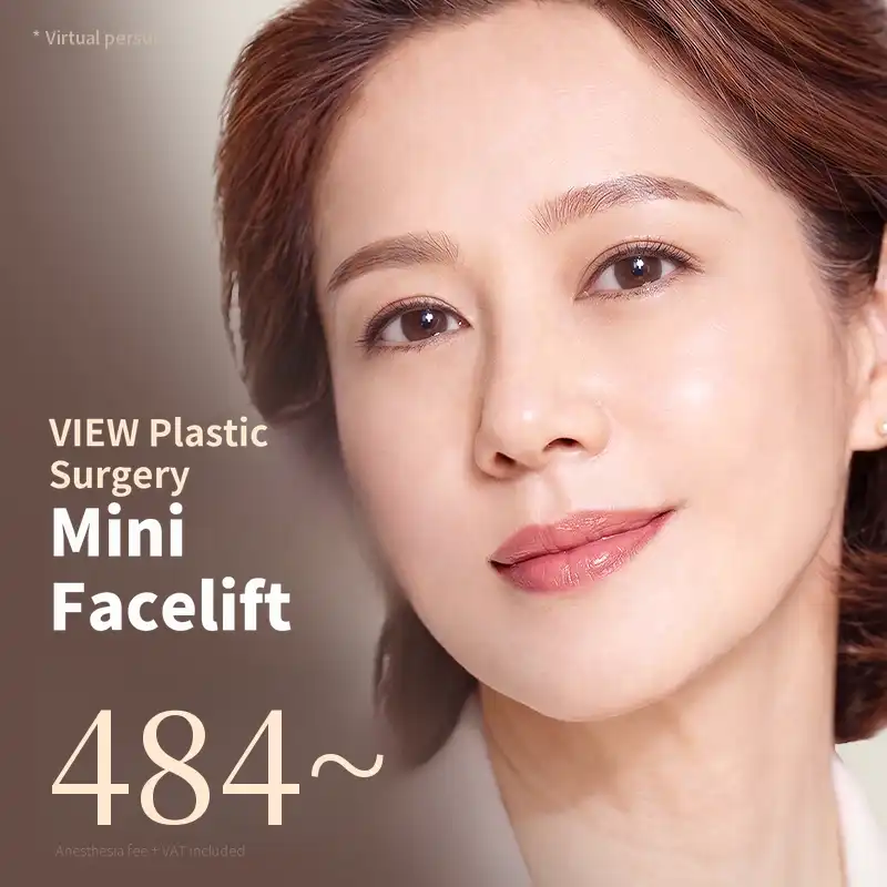 ❤View❤ Mini Facelift
