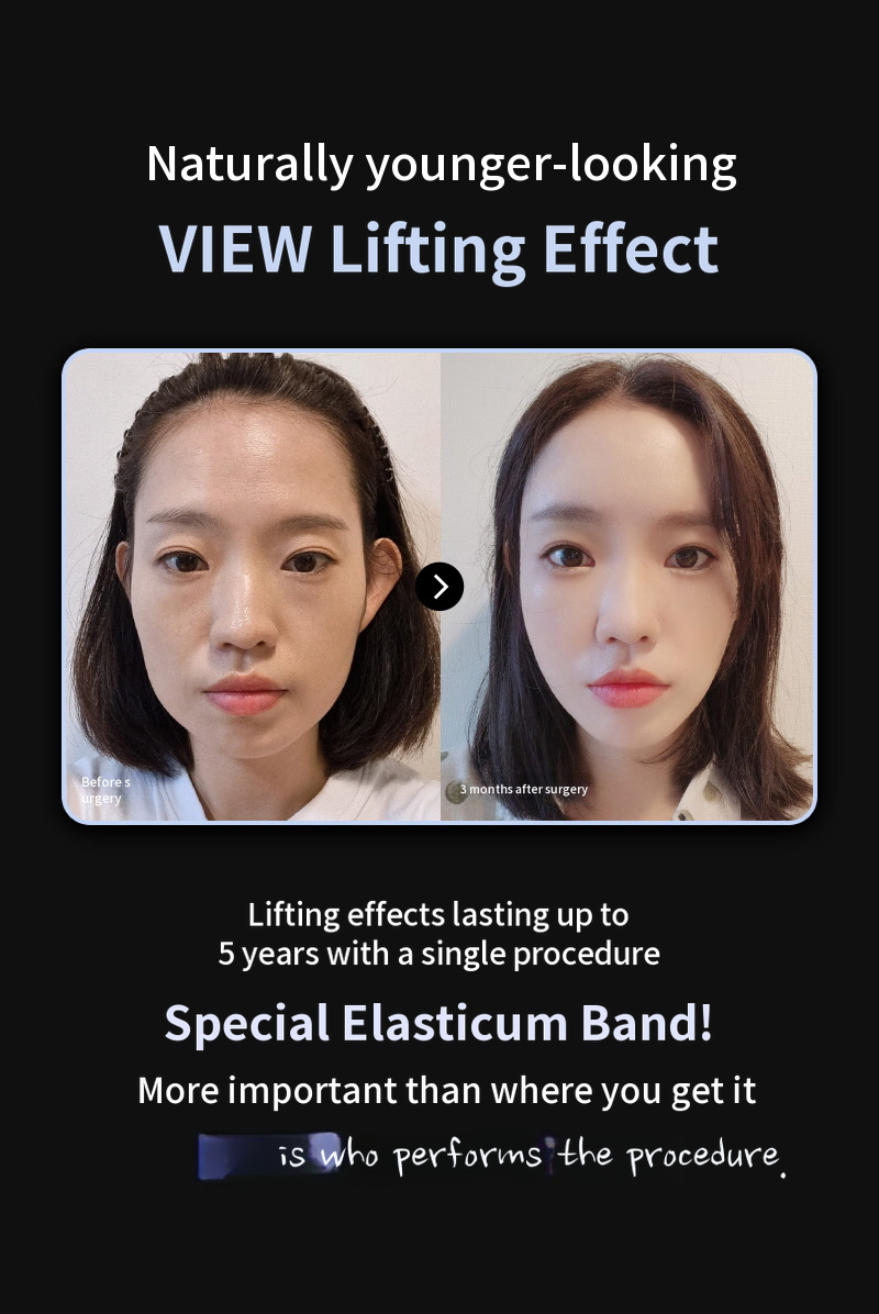 ❤️View❤️ Elastics Silhouette Lifting