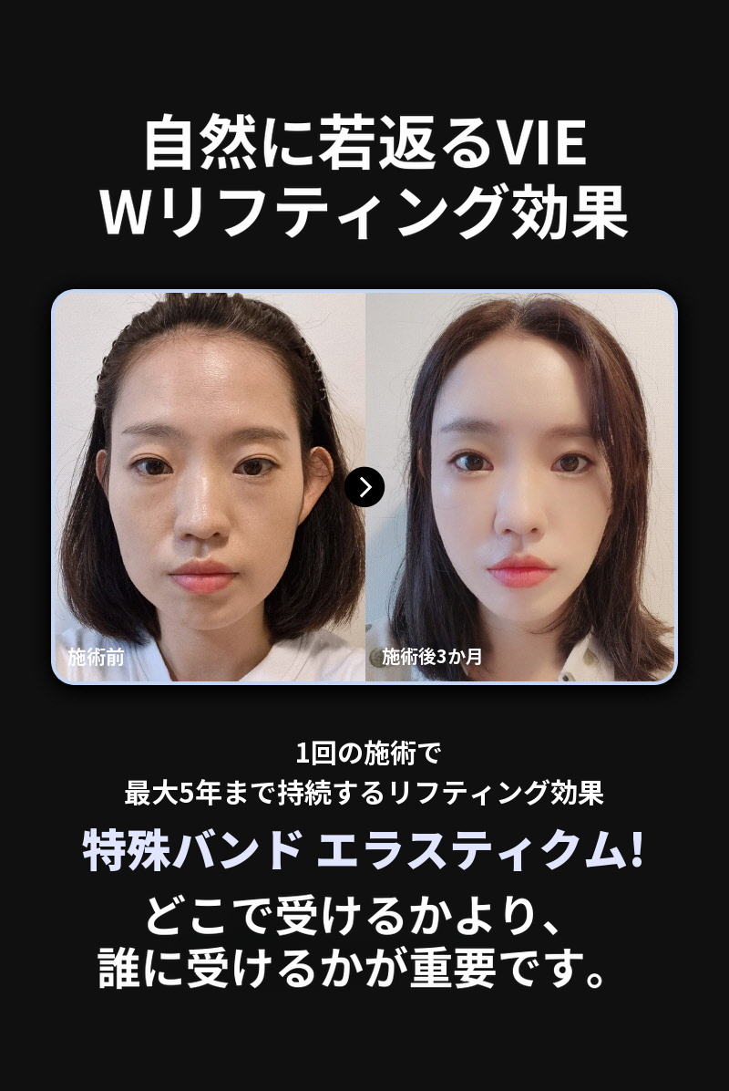 ❤ビュー❤エラスティクーム シリフトニング