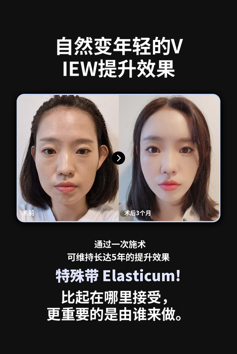 ❤视图❤弹性梦 硅胶提升