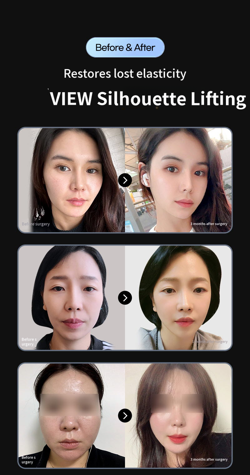 ❤️View❤️ Elastics Silhouette Lifting