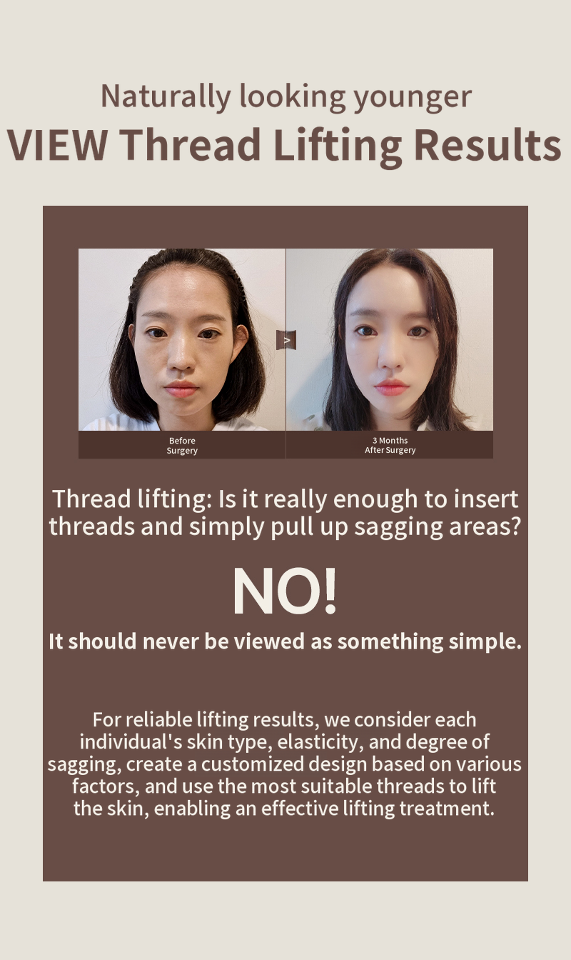 ❤View❤ Thread Lift