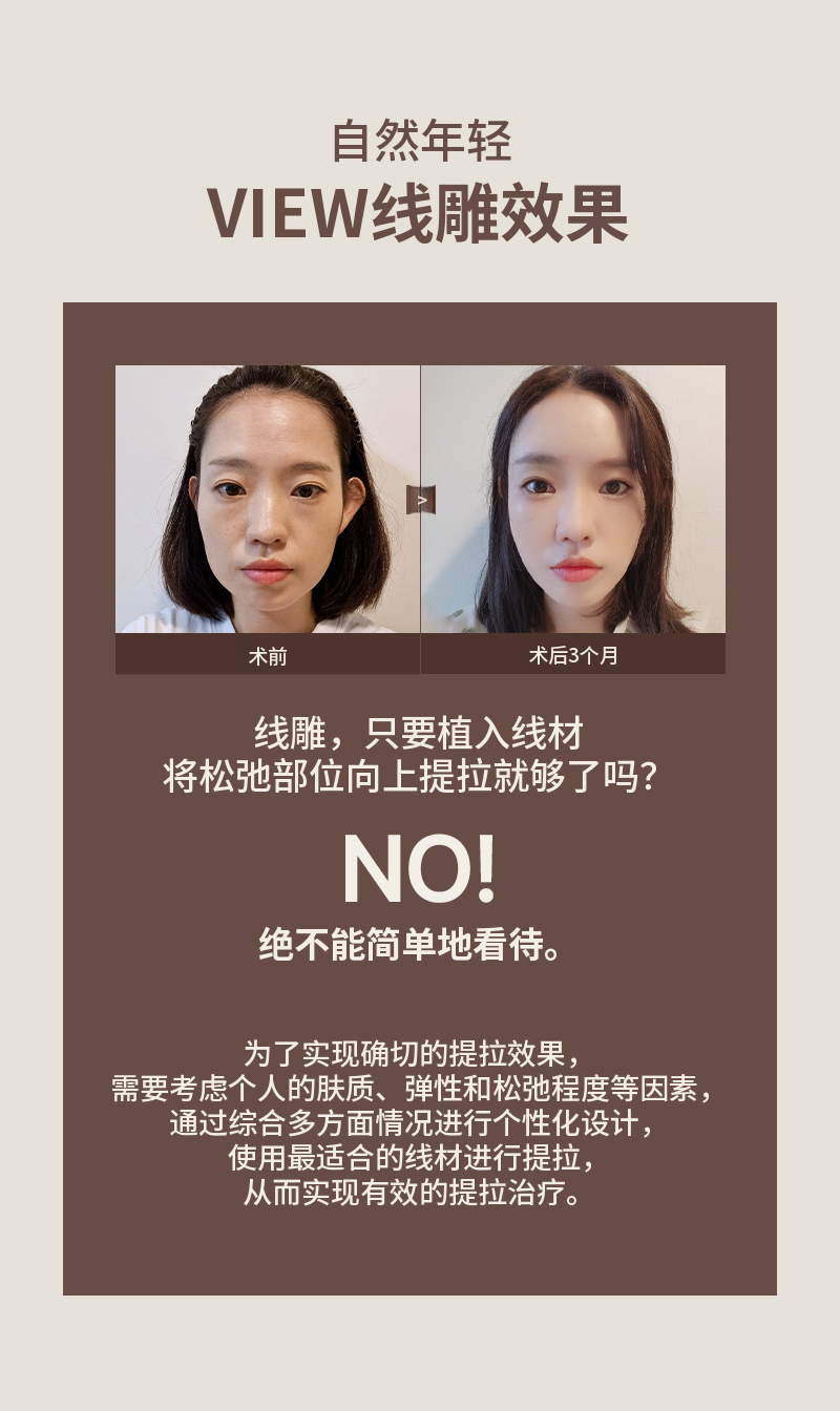 ❤维❤埋线提升