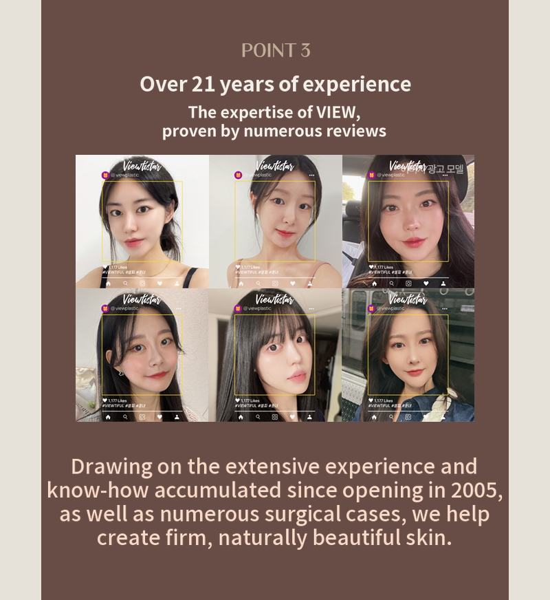 ❤View❤ Thread Lift