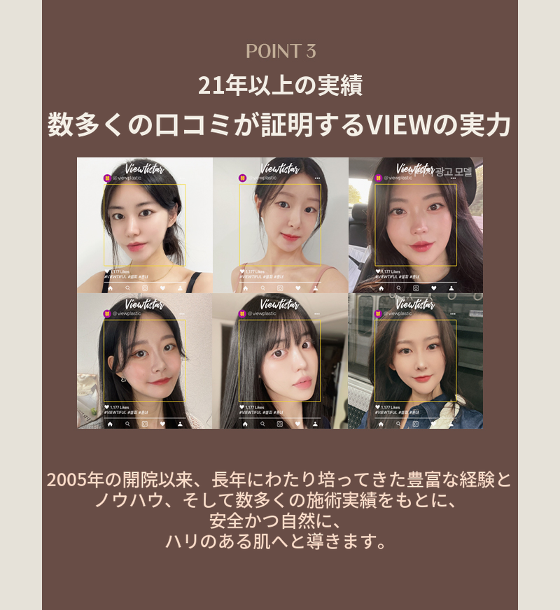 ❤ビュー❤糸リフト