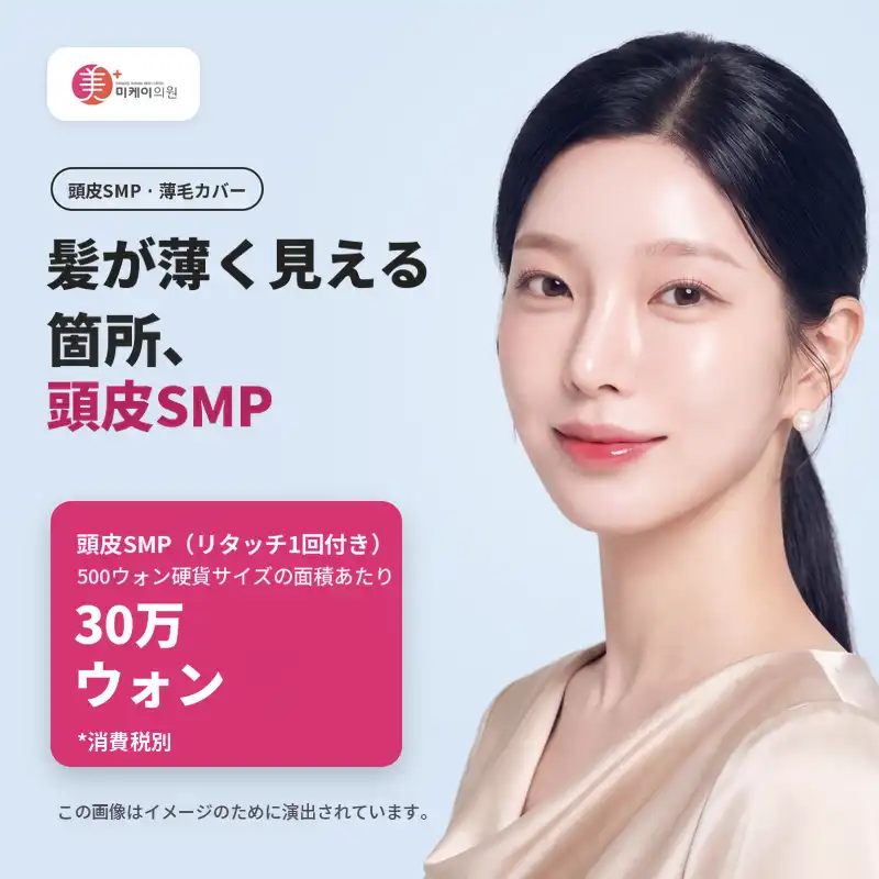 ミケイ 頭皮SMP（ヘアライン半永久）