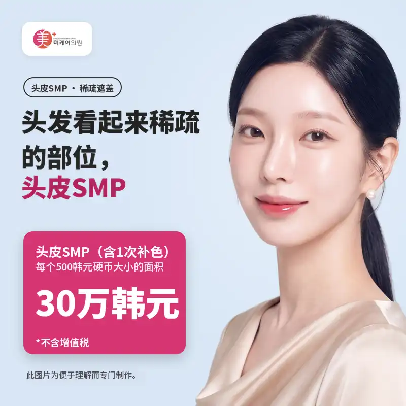 米凯头皮SMP发际线半永久