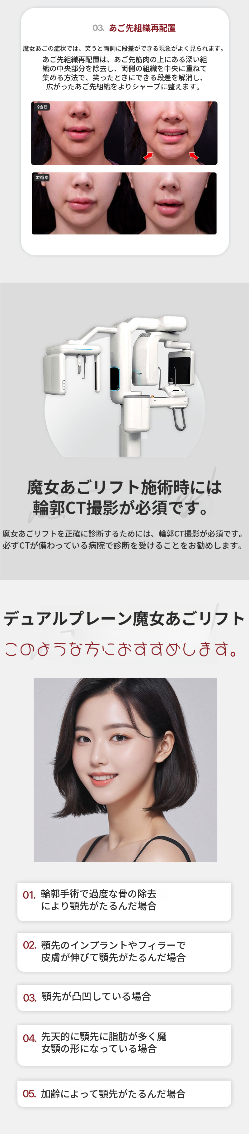 リターニング 魔女あごリフト