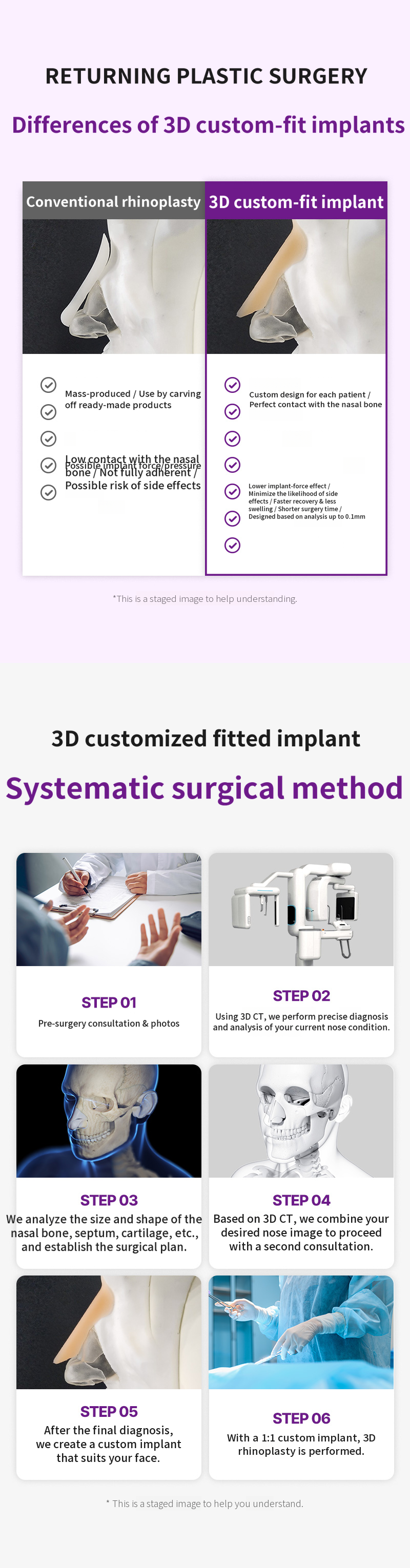 Returning 3D Fit Me Custom Implant