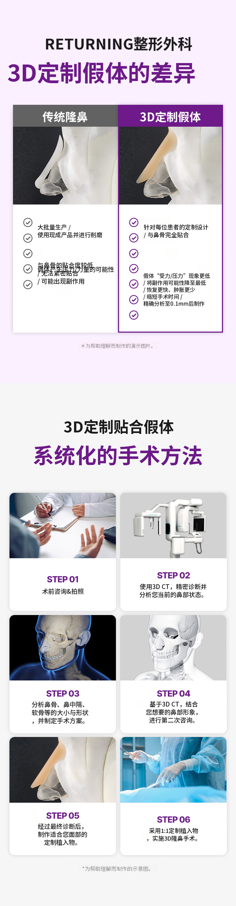 リターニング3Dフィットミコカスタムインプラント