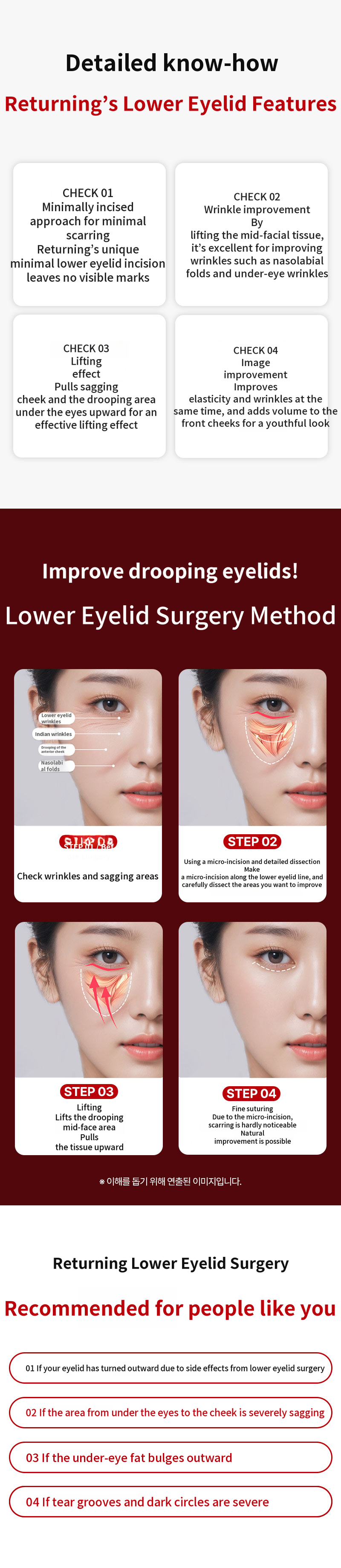 Lower Blepharoplasty