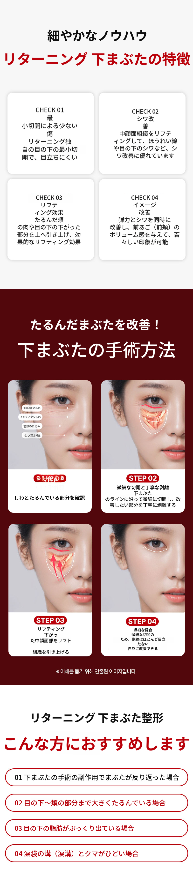 リターニング下眼瞼