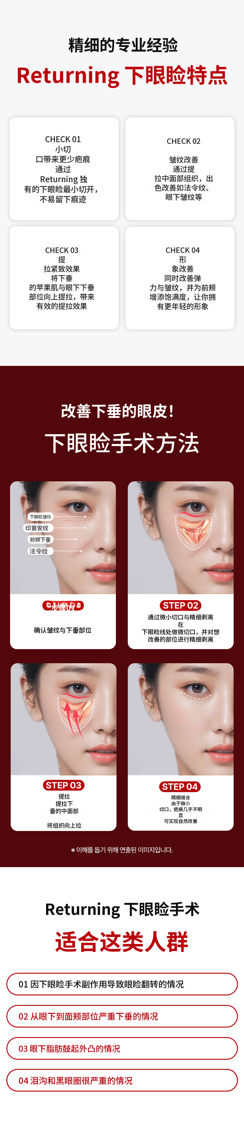 重塑下眼睑