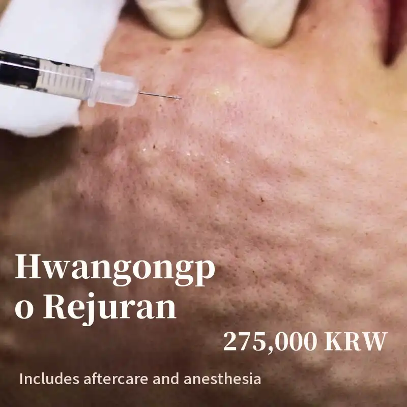 Hwan-gong Po Rejuran 2cc + Skin Diagnosis + Soothing Care