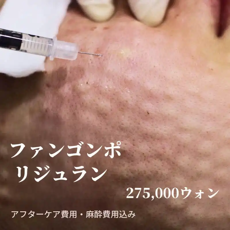 ファンコウポリジュラン 2cc + 肌診断 + 鎮静管理