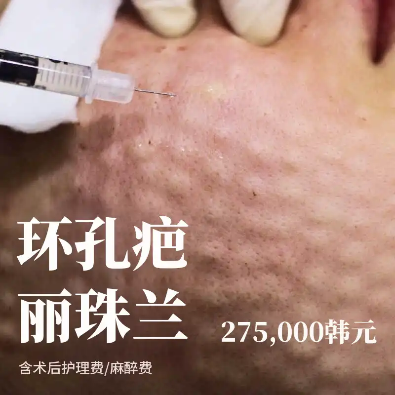 环恐丽珠兰2cc+皮肤诊断+舒缓护理