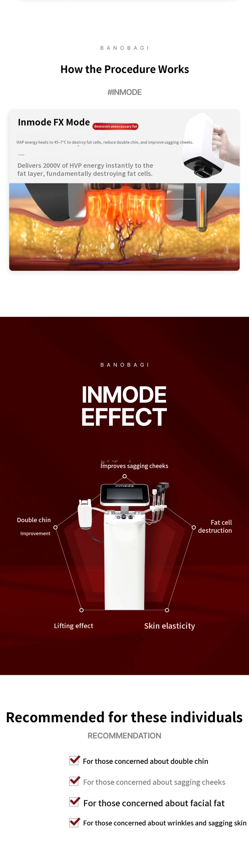 InMode FX Full Face