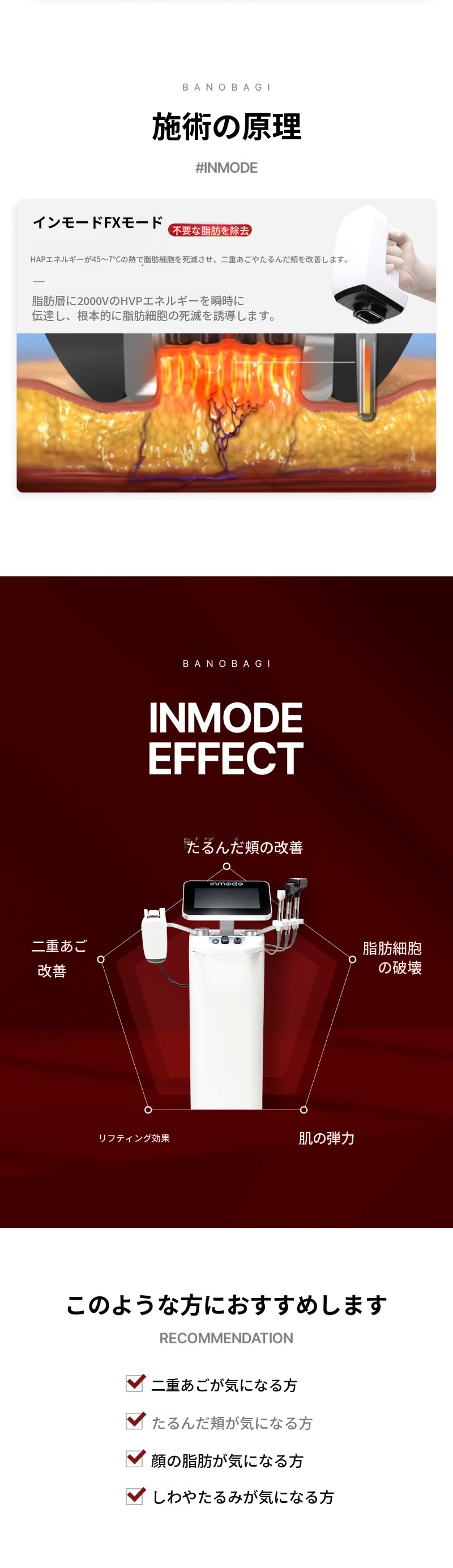インモードFX 全顔