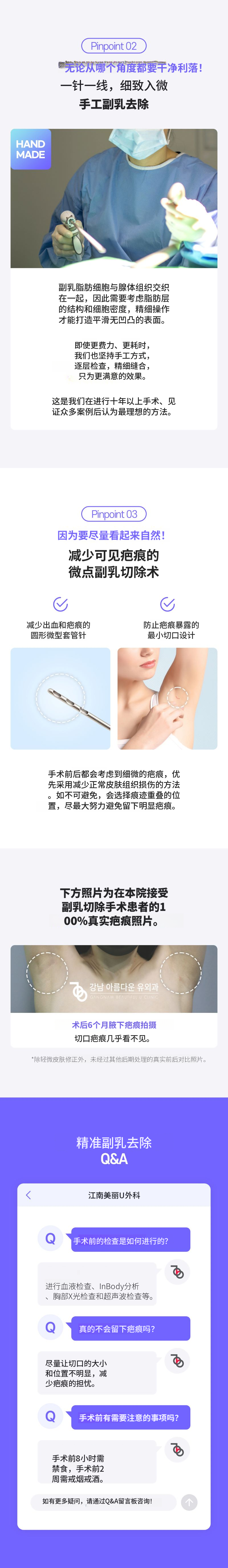 腋下乳腺小点去除
