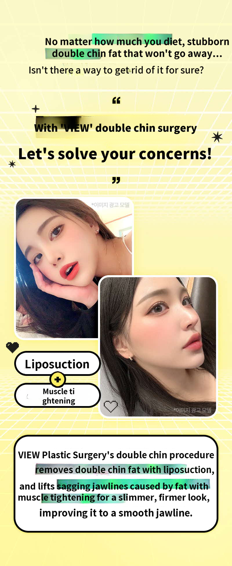 ❤View❤Facial Liposuction