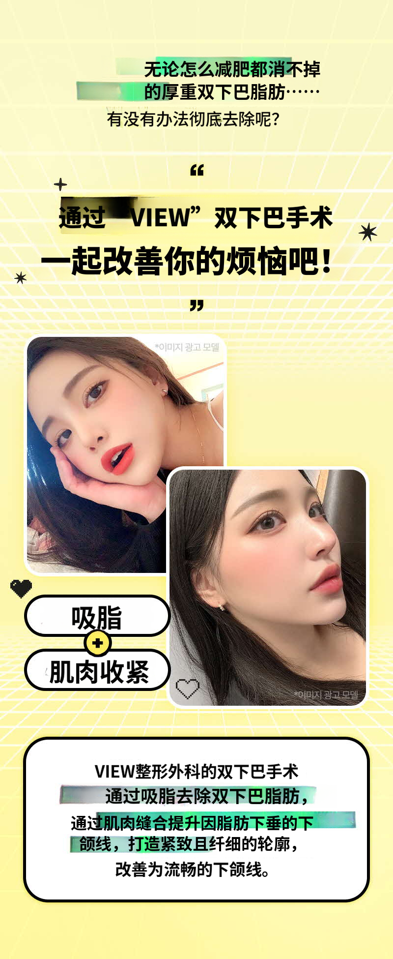 ❤视美❤面部吸脂